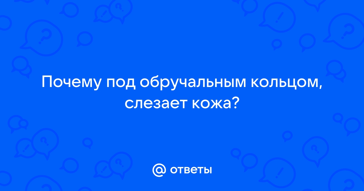 Ожог от кольца на пальце: причины и способы избавления