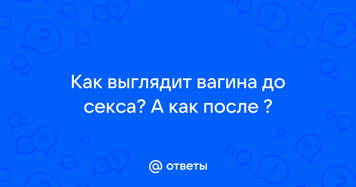 Нормально ли пукать вагиной и можно ли этого избежать