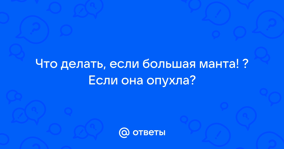 Проба Манту - процедура, противопоказания, альтернативы