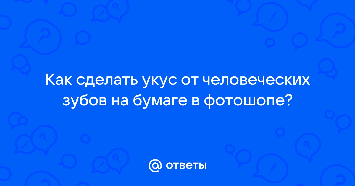 УКУСИЛИ! Как помочь ребенку при укусе насекомых