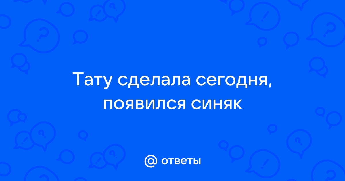 История одного синяка или тату на ноге | Пикабу