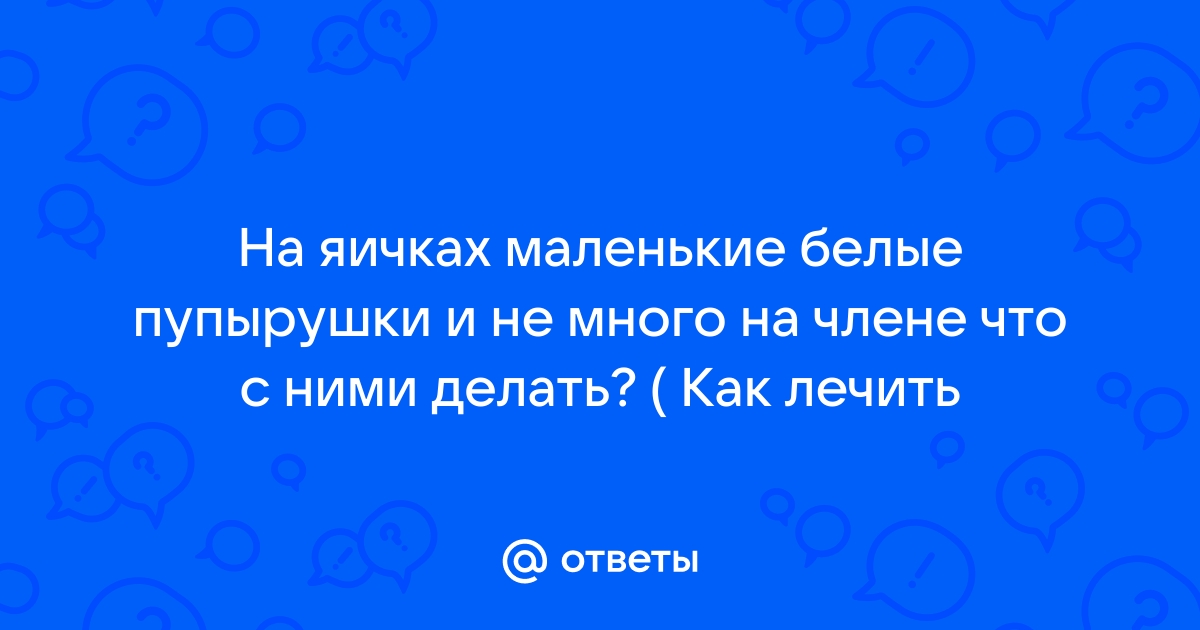 Гребаный стыд 🛏 Яйцо в пизде 🛏 Последние 🛏 1 🛏 Блестящая коллекция