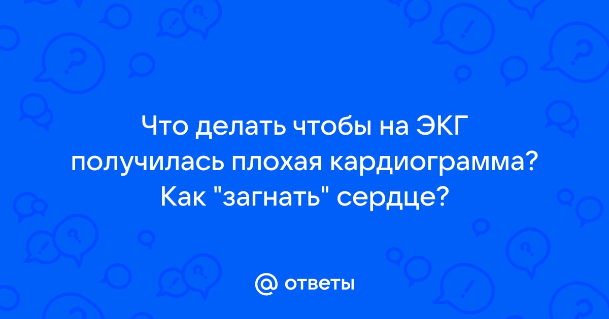 Как проходить ЭКГ без проблем, чтобы не возникало трудностей с постановкой диагноза? - Линия жизни