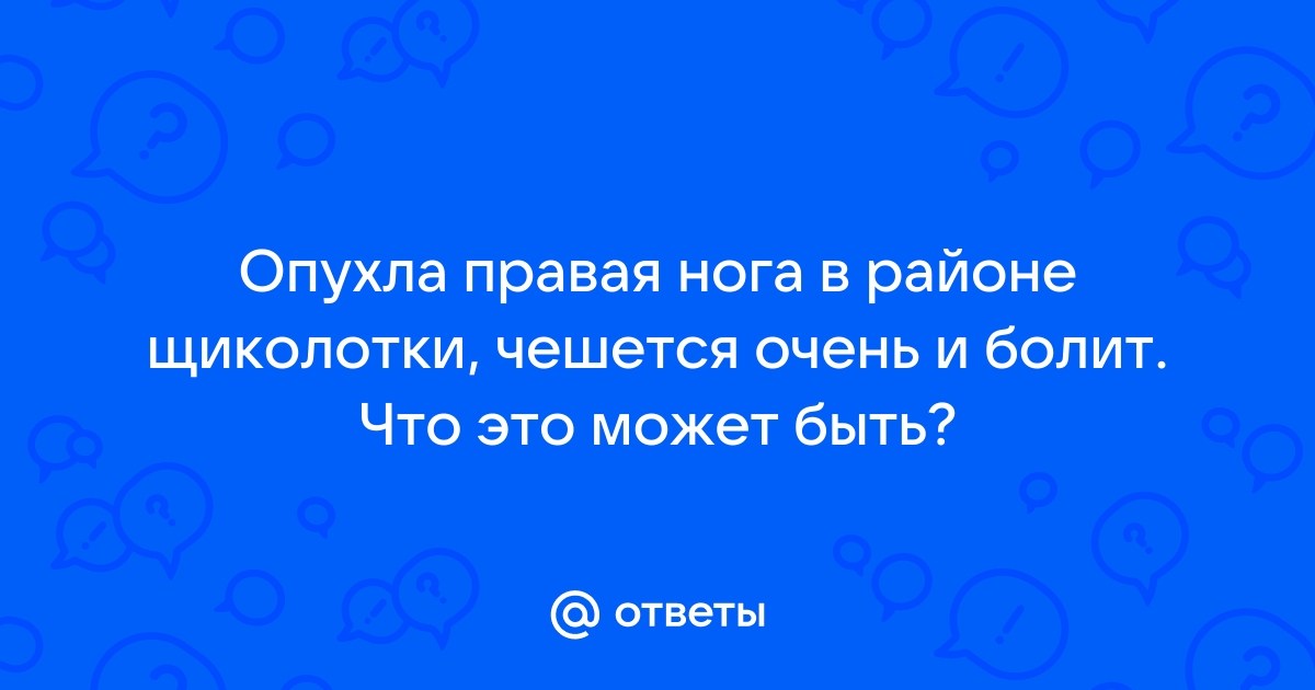 Как избавиться от отека и покраснения ног: причины, рекомендации | Статьи от Центра Флебологии