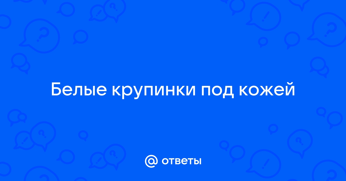 Как избавиться от милиумов на лице? - статьи многопрофильной клиники «Дезир»