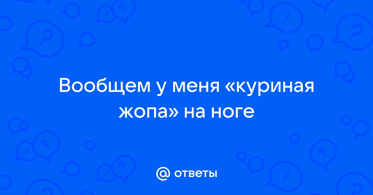 Как избавиться от куриной бородавки на стопе в домашних условиях