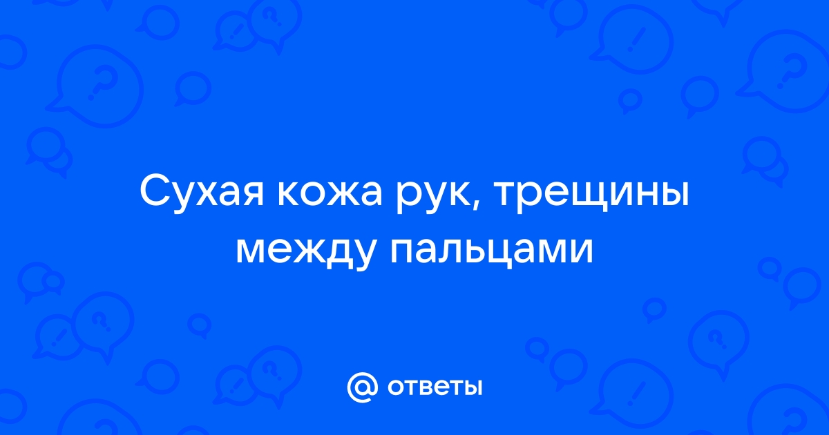 Перелом пальца - симптомы, причины и лечение | «СМ-Клиника»