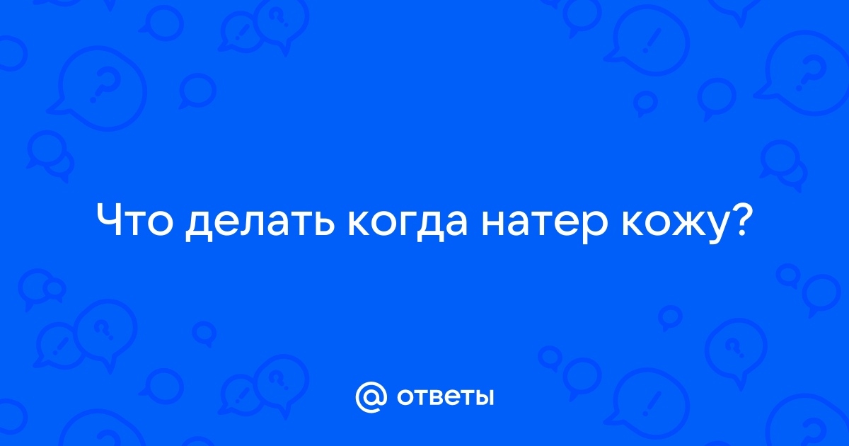 Ожоги, ушибы и травмы глаз: как оказать первую помощь