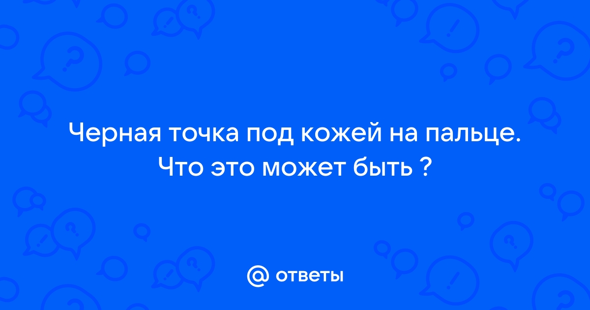 Лопаются вены на пальцах рук — вопрос №7073