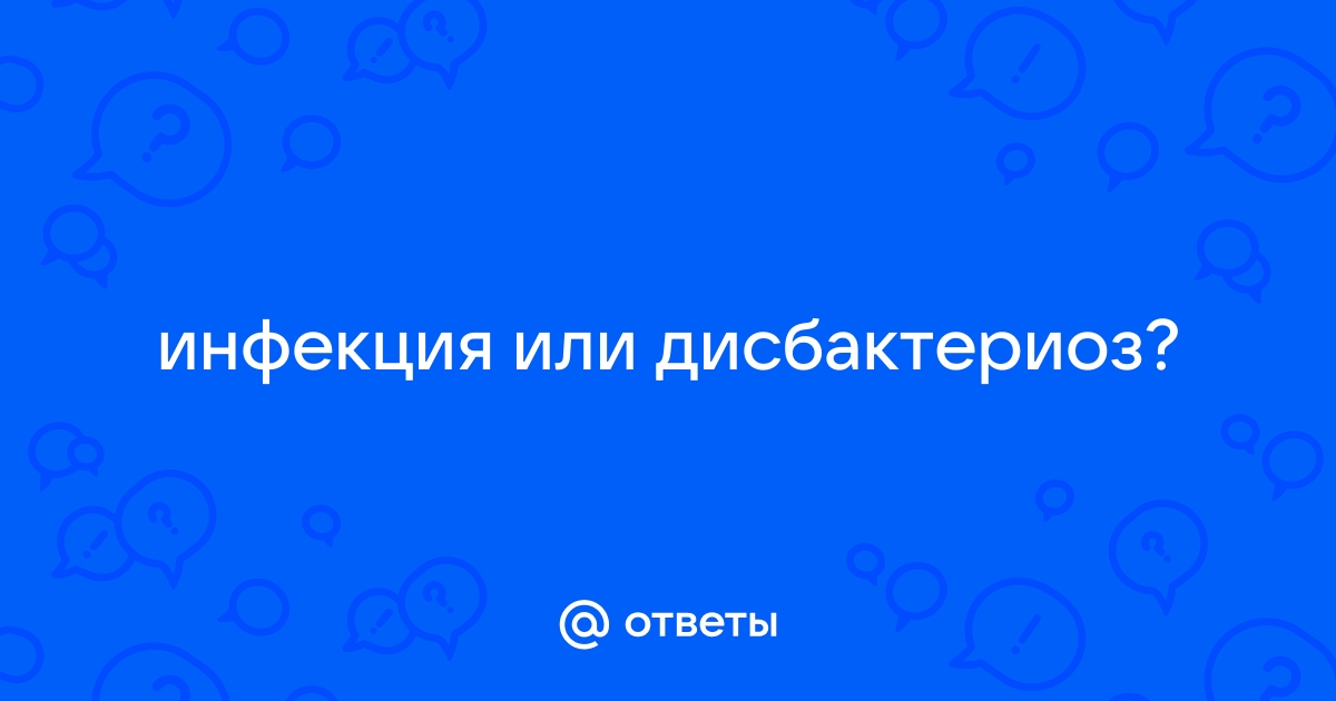 Черный стул от фосфалюгеля