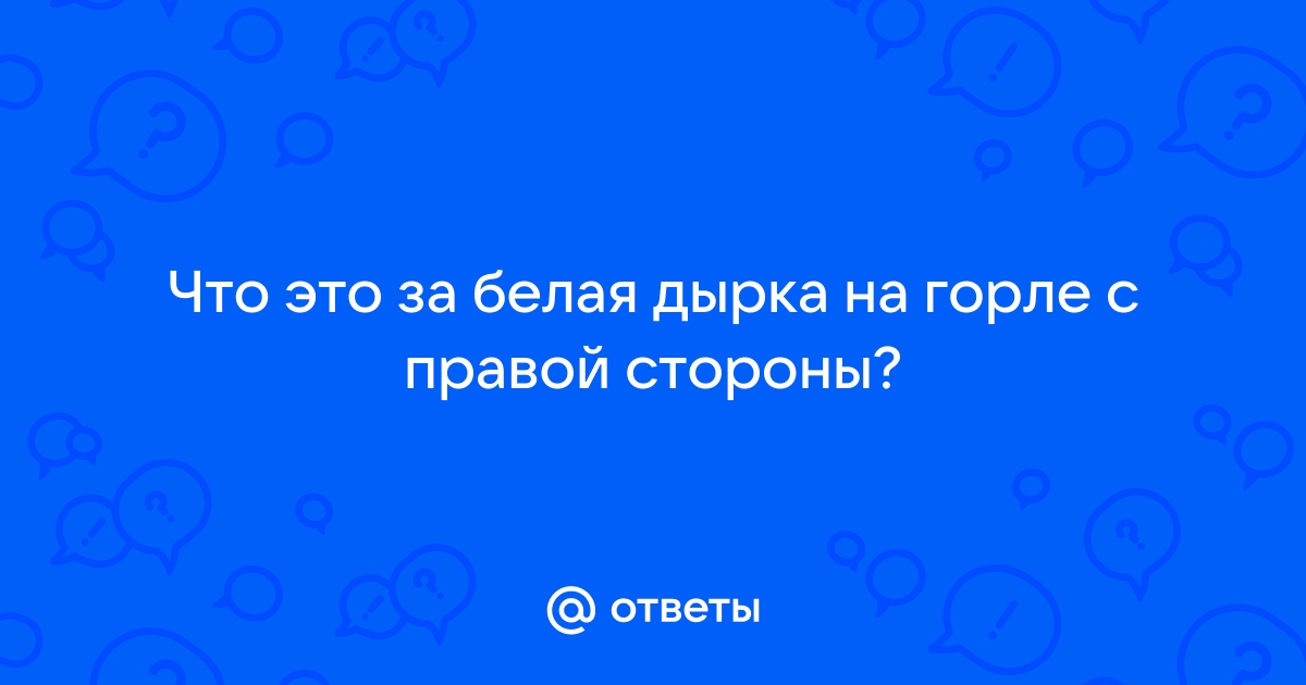 Ангина - симптомы, как лечить ангину, признаки и фото