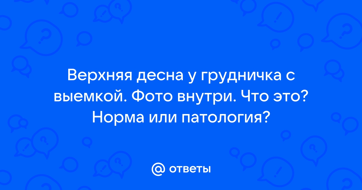 Прорезывание зубов у детей: что нужно знать родителям - Статьи - Стоматология «Эталон»