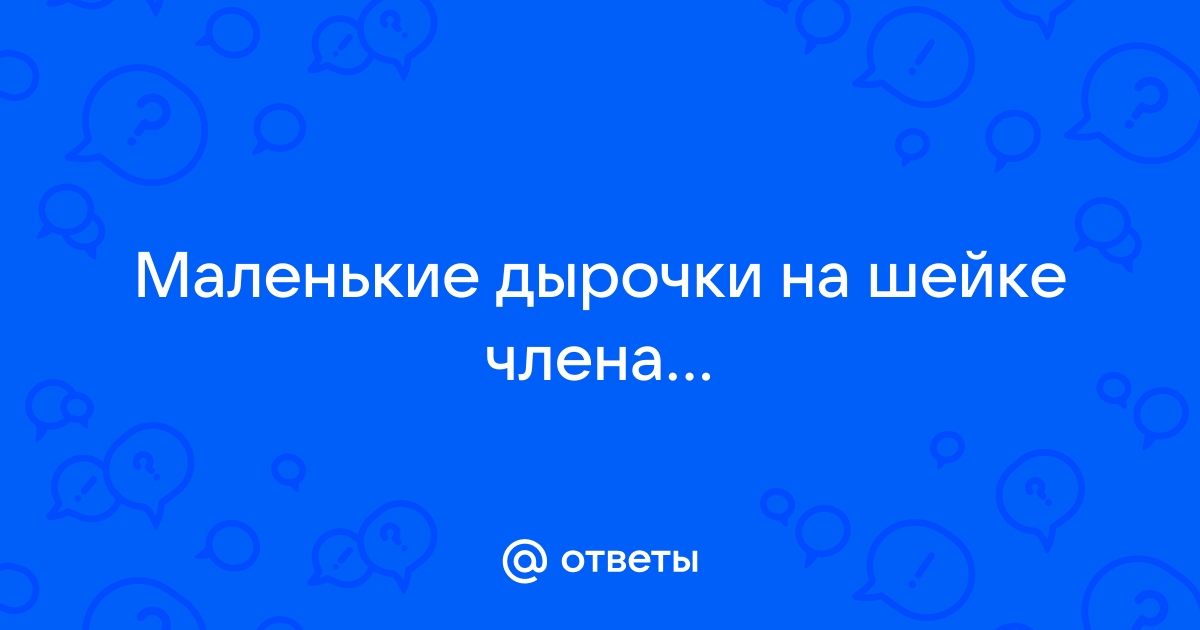 Гипоспадия у детей — лечение, диагностика, симптомы и причины болезни | Николаев В.В.