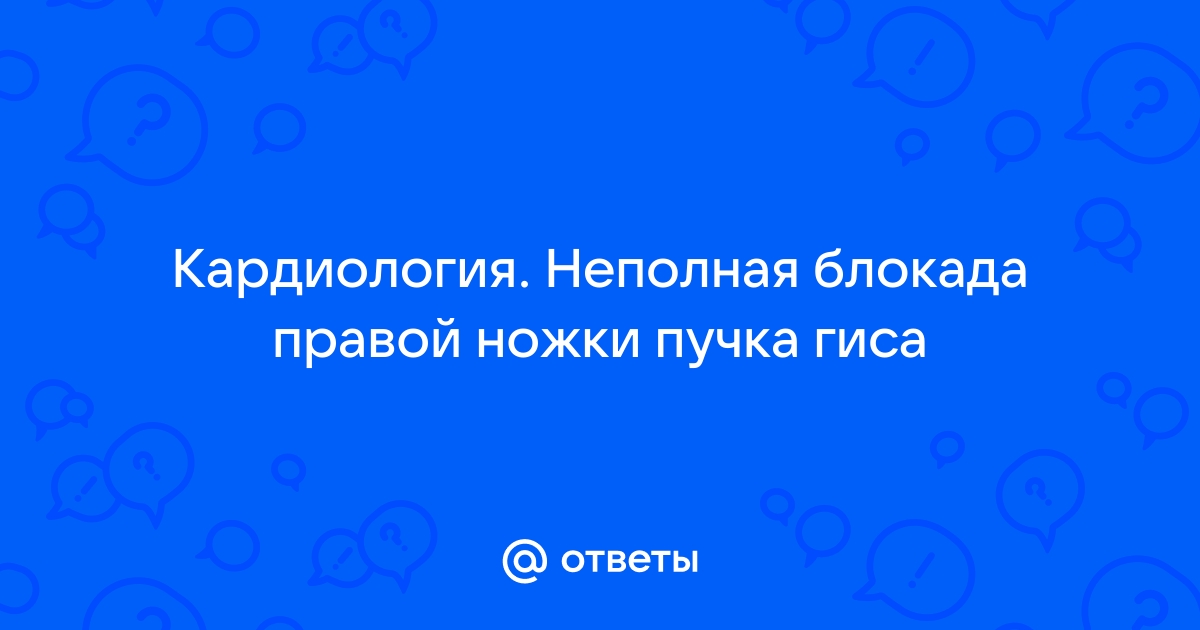 Блокада правой ножки пучка (I45.0)