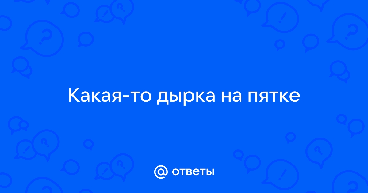 Мозоль корневая (стержневая) | Центр подологии и остеопатии Татьяны Красюк