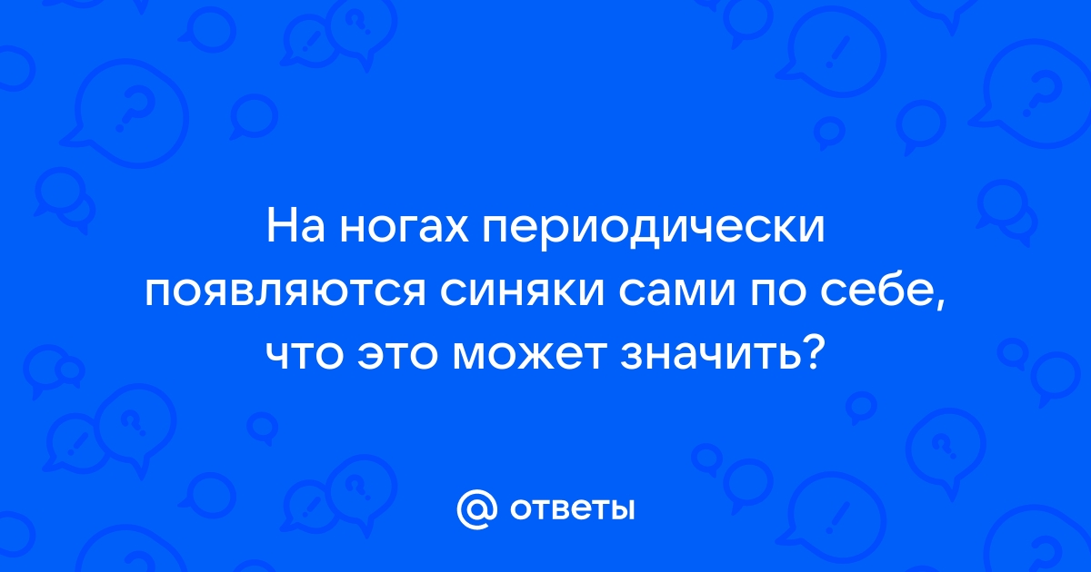 Синяки на ногах: в чем причина и как лечить