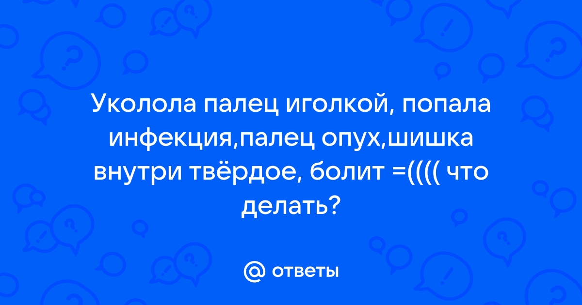 Опух палец на руке | Причины и лечение | «ЗдравКлиник»