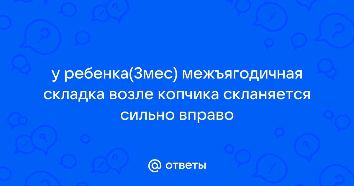 О чем расскажут несимметричные складки на ножках грудничка