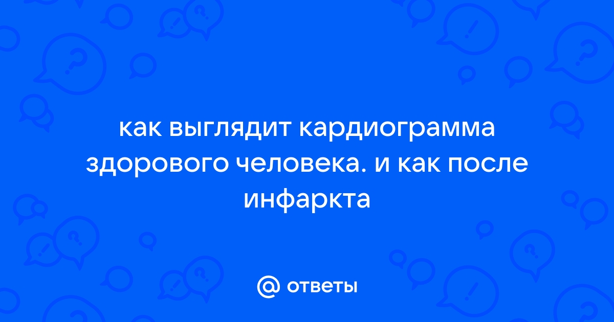 Как создать кардиограмму на компьютере