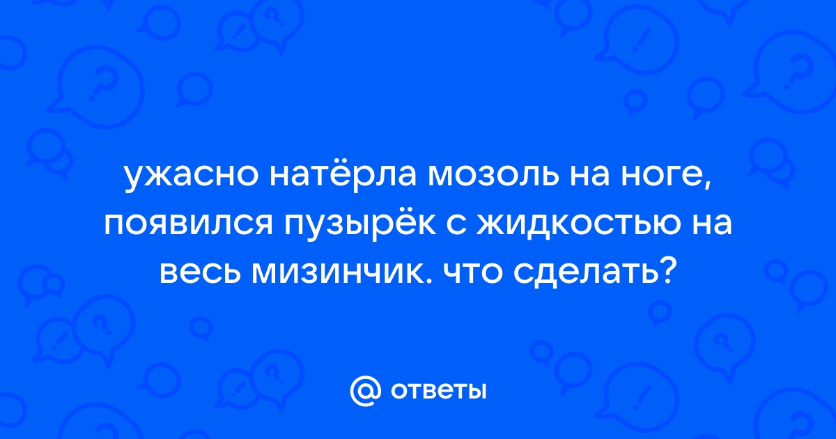 Водяная мозоль: как себе помочь? ✓ Авторские статьи Клиники подологии Полёт в Москве