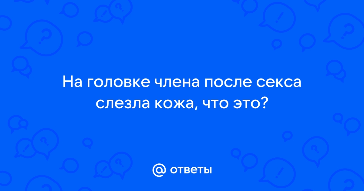 Воспаление кожи головки члена (баланит): диагностика и лечение