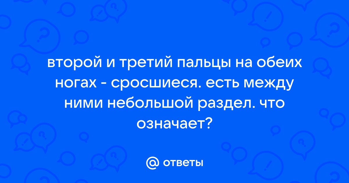 Ответы поверка36.рф: У кого чаще могут быть сросшиеся пальцы на ногах, у мужчин или у женщин????