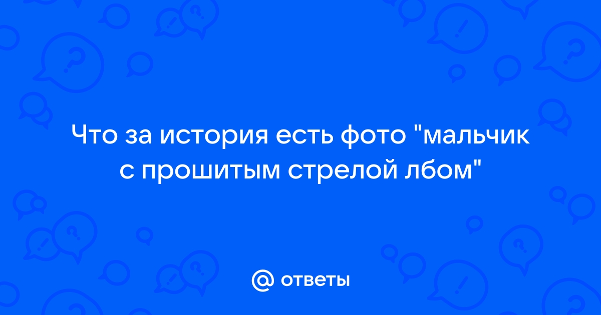 Врачи оперировали ребёнка со стрелой в голове