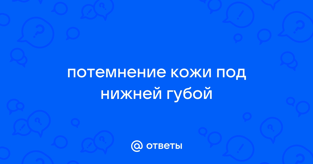 Цианоз (синюшность кожного покрова) - причины и лечение